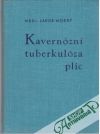 Kavernzn tuberkulza plic